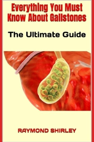 Cover of Everything You Must Know About Gallstones