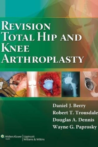 Cover of Revision Total Hip and Knee Arthroplasty