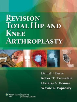 Book cover for Revision Total Hip and Knee Arthroplasty