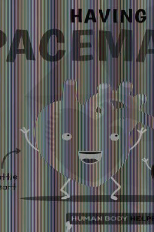 Cover of Having a Pacemaker