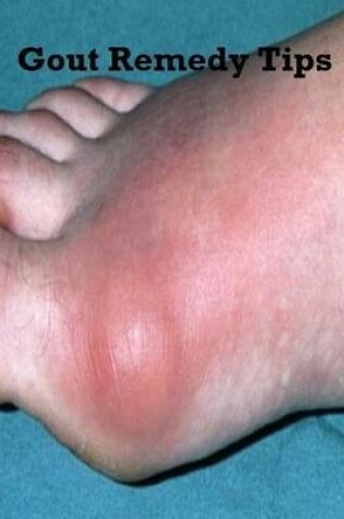 Cover of Gout Remedy Tips