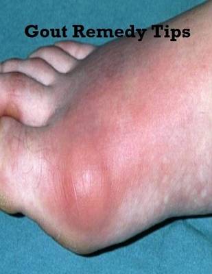 Book cover for Gout Remedy Tips