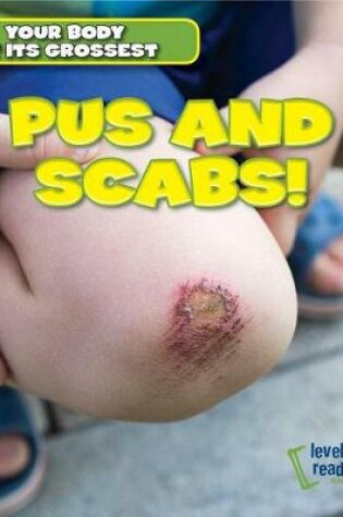 Cover of Pus and Scabs!