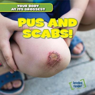 Book cover for Pus and Scabs!