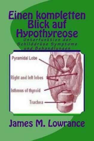 Cover of Einen kompletten Blick auf Hypothyreose