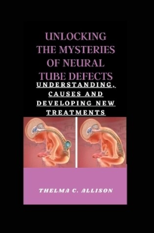 Cover of Unlocking the Mysteries of Neural Tube Defects