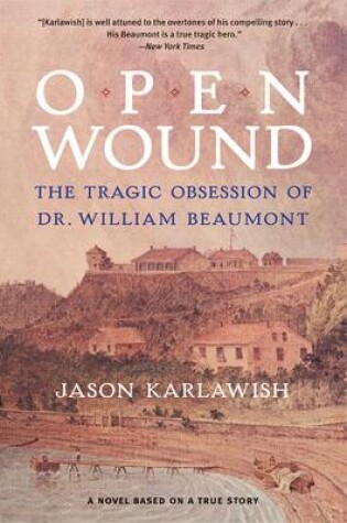 Cover of Open Wound