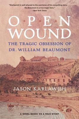 Book cover for Open Wound