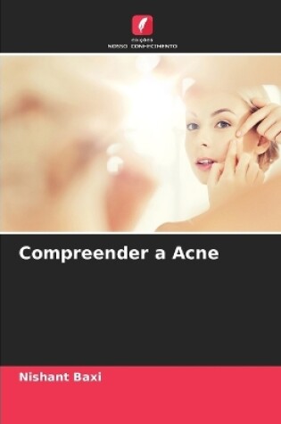 Cover of Compreender a Acne