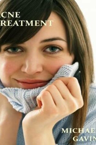 Cover of Acne Treatment: What Experts Don't Want You to Know