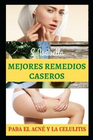 Cover of Mejores Remedios Caseros