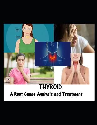 Book cover for Thyroid