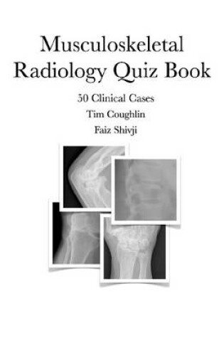 Cover of Musculoskeletal Radiology Quiz Book: 50 Clinical Cases