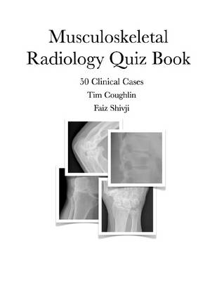 Book cover for Musculoskeletal Radiology Quiz Book: 50 Clinical Cases