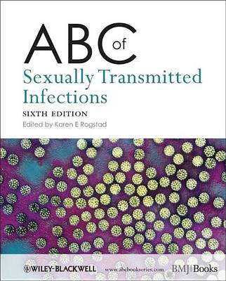 Book cover for ABC of Sexually Transmitted Infections