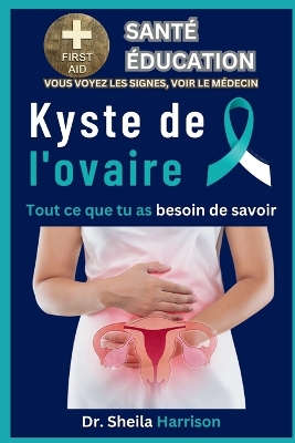 Book cover for Kyste de l'ovaire