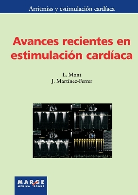 Book cover for Avances recientes en estimulación cardíaca