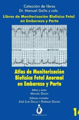 Cover of Atlas de Monitorizacion Biofisica Fetal Anormal En El Embarazo Y Parto