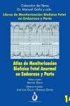 Book cover for Atlas de Monitorizacion Biofisica Fetal Anormal En El Embarazo Y Parto