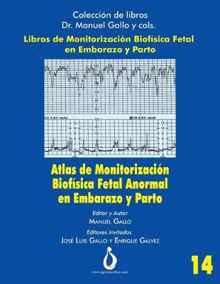 Book cover for Atlas de Monitorizacion Biofisica Fetal Anormal En El Embarazo Y Parto