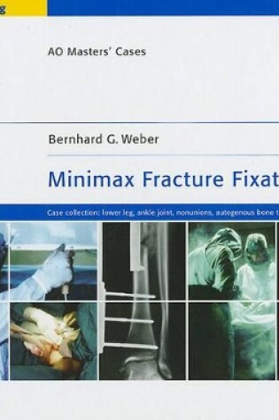 Cover of Minimax Fracture Fixation