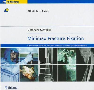 Book cover for Minimax Fracture Fixation