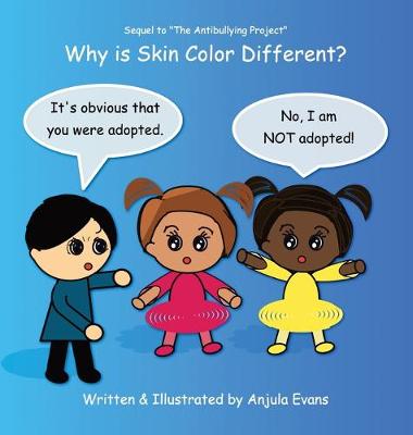 Cover of Why Is Skin Color Different?