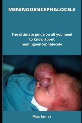 Book cover for Meningoencephalocele