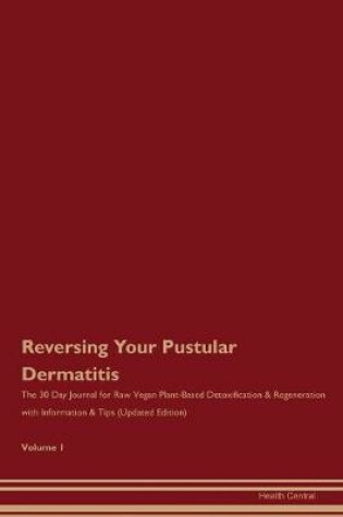 Cover of Reversing Your Pustular Dermatitis