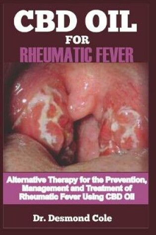 Cover of CBD Oil for Rheumatic Fever