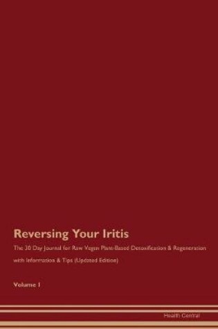 Cover of Reversing Your Iritis