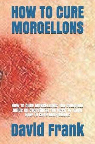 Cover of How to Cure Morgellons