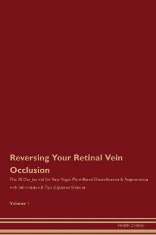 Cover of Reversing Your Retinal Vein Occlusion