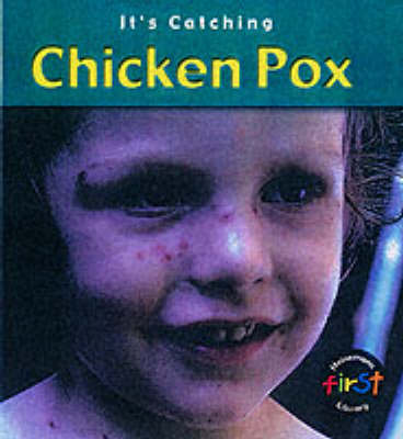 Cover of It's Catching: Chicken Pox