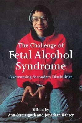 Book cover for The Challenge of Fetal Alcohol Syndrome