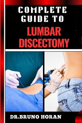 Book cover for Complete Guide to Lumbar Discectomy