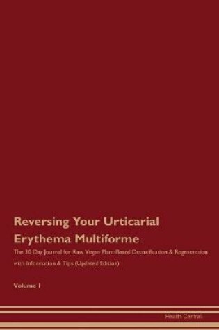 Cover of Reversing Your Urticarial Erythema Multiforme