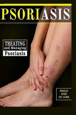 Cover of Psoriasis