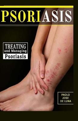 Book cover for Psoriasis