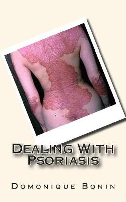 Book cover for Dealing With Psoriasis