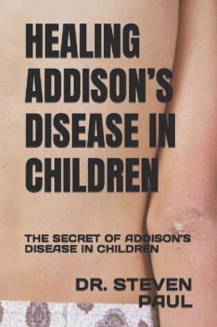 Cover of Healing Addison's Disease in Children