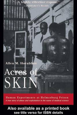 Book cover for Acres of Skin