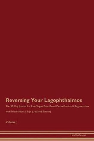 Cover of Reversing Your Lagophthalmos