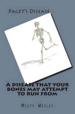 Cover of A disease that your bones may attempt to run from