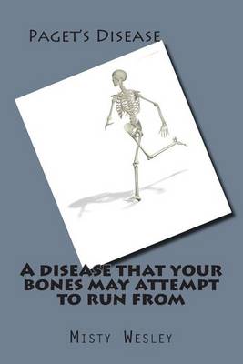 Book cover for A disease that your bones may attempt to run from