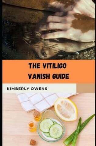 Cover of The Vitiligo Vanish Guide