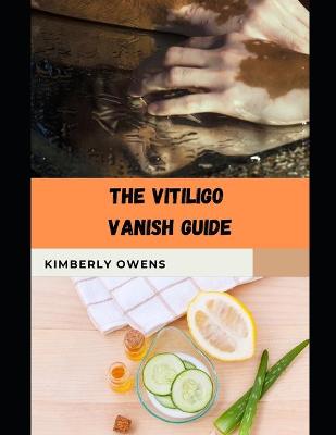 Book cover for The Vitiligo Vanish Guide