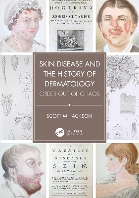 Book cover for Skin Disease and the History of Dermatology