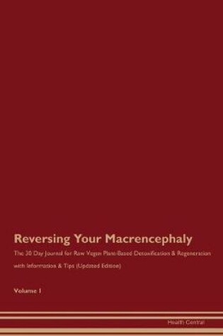 Cover of Reversing Your Macrencephaly