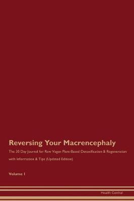 Book cover for Reversing Your Macrencephaly